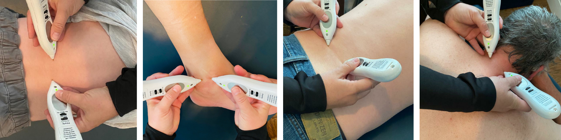 Dolphin Neurostimulation, or Microcurrent Point Stimulation: What Is It ...